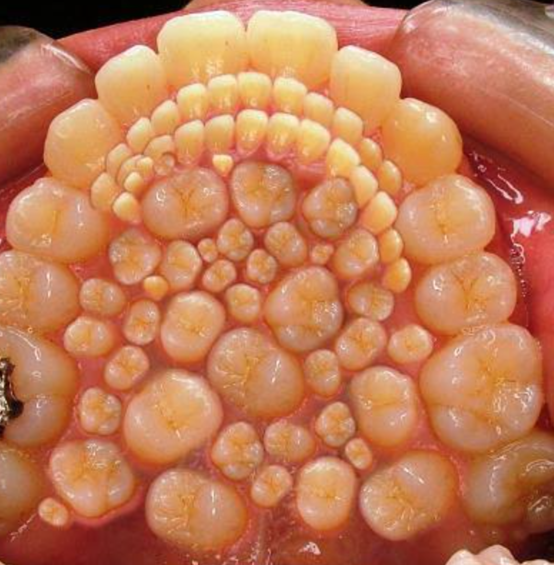 【閲覧注意】色んな集合体の画像を集めようPart6