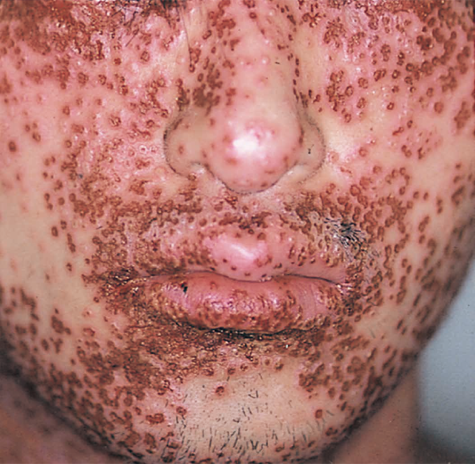 【閲覧注意】色んな集合体の画像を集めようPart6