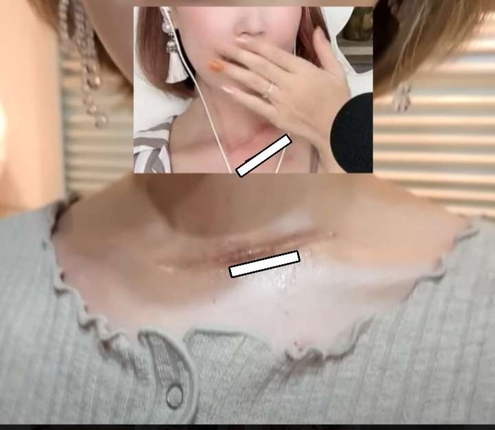 32歳女「白血病再発し余命3カ月」とウソ付き60代男性から1000万円だまし取った疑いで逮捕…病院の請求書偽造し被害額2900万円以上も