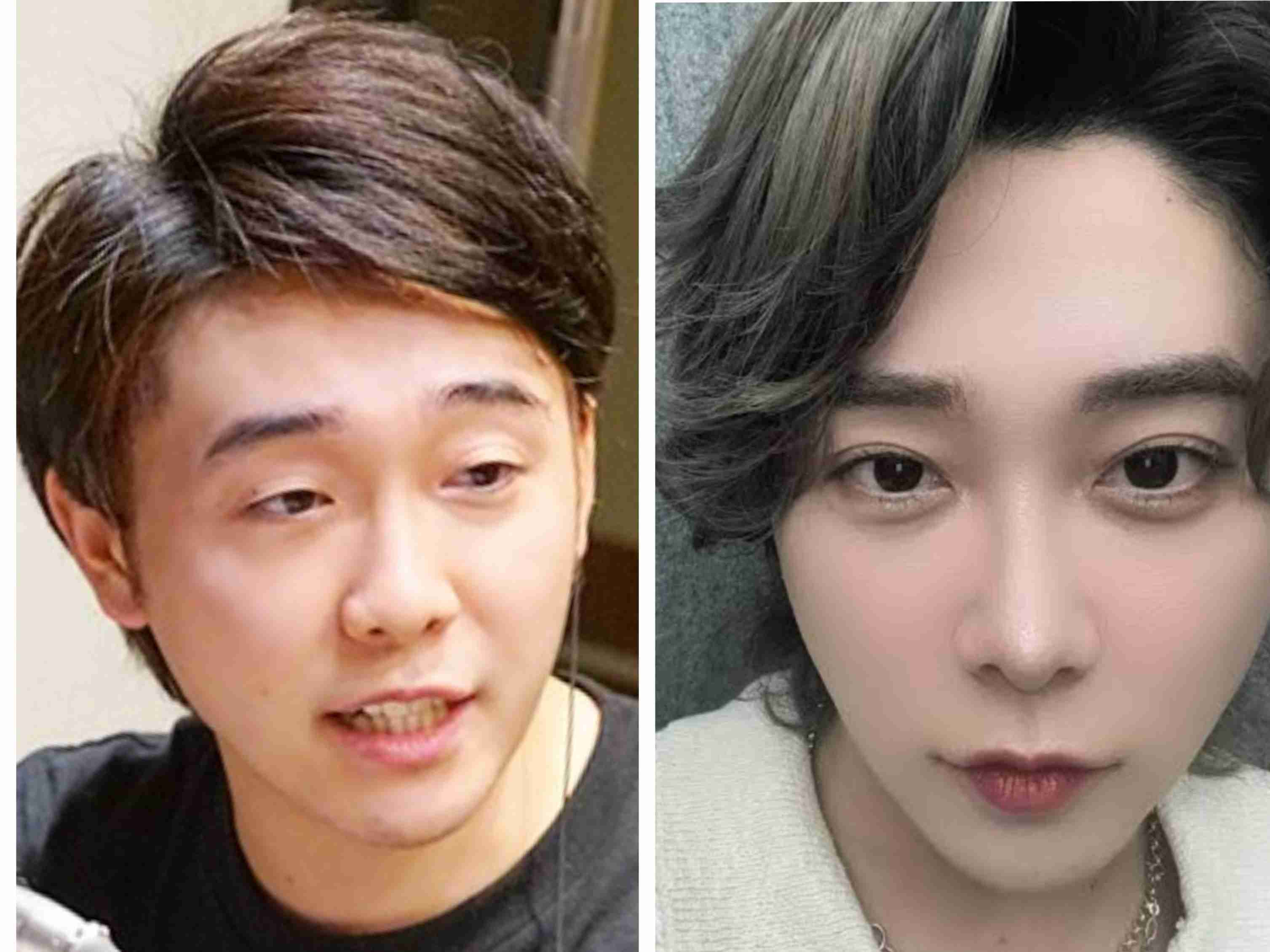 「そのお口はなんだい」ミセス大森元貴、アヒル口強調キャスケット＆メガネ姿のあざと自撮りに悲鳴「この可愛さは凶器」