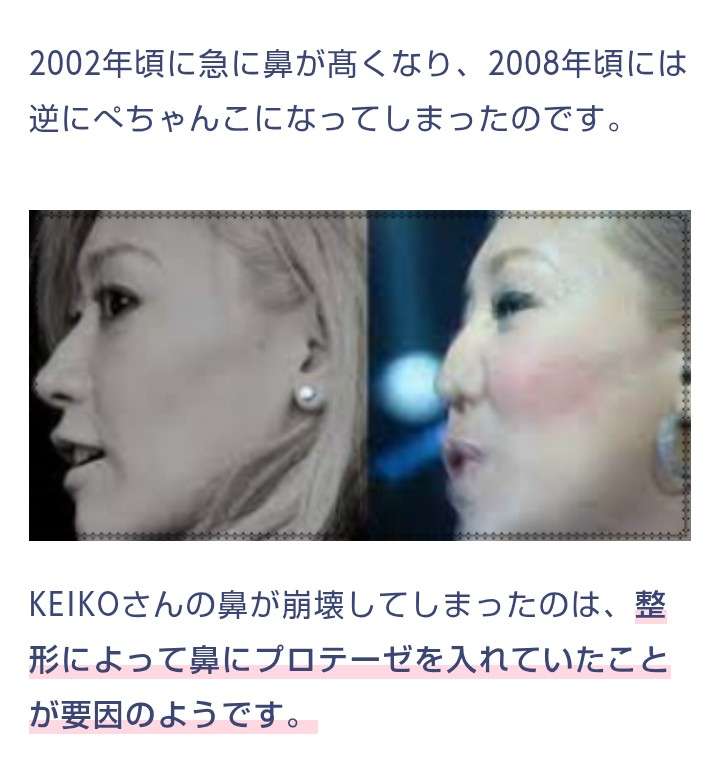 整形って見抜けちゃうんですか?