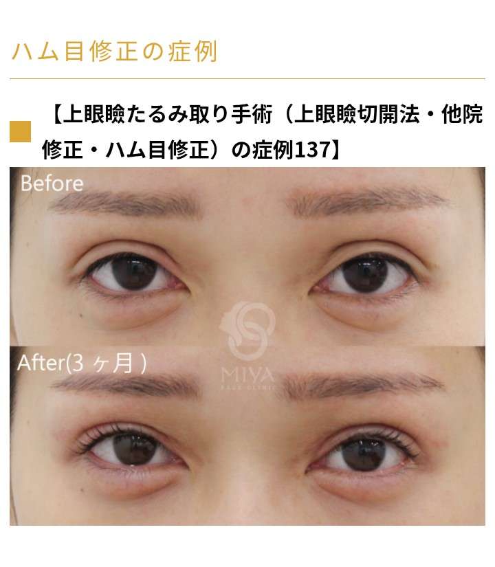 整形って見抜けちゃうんですか?