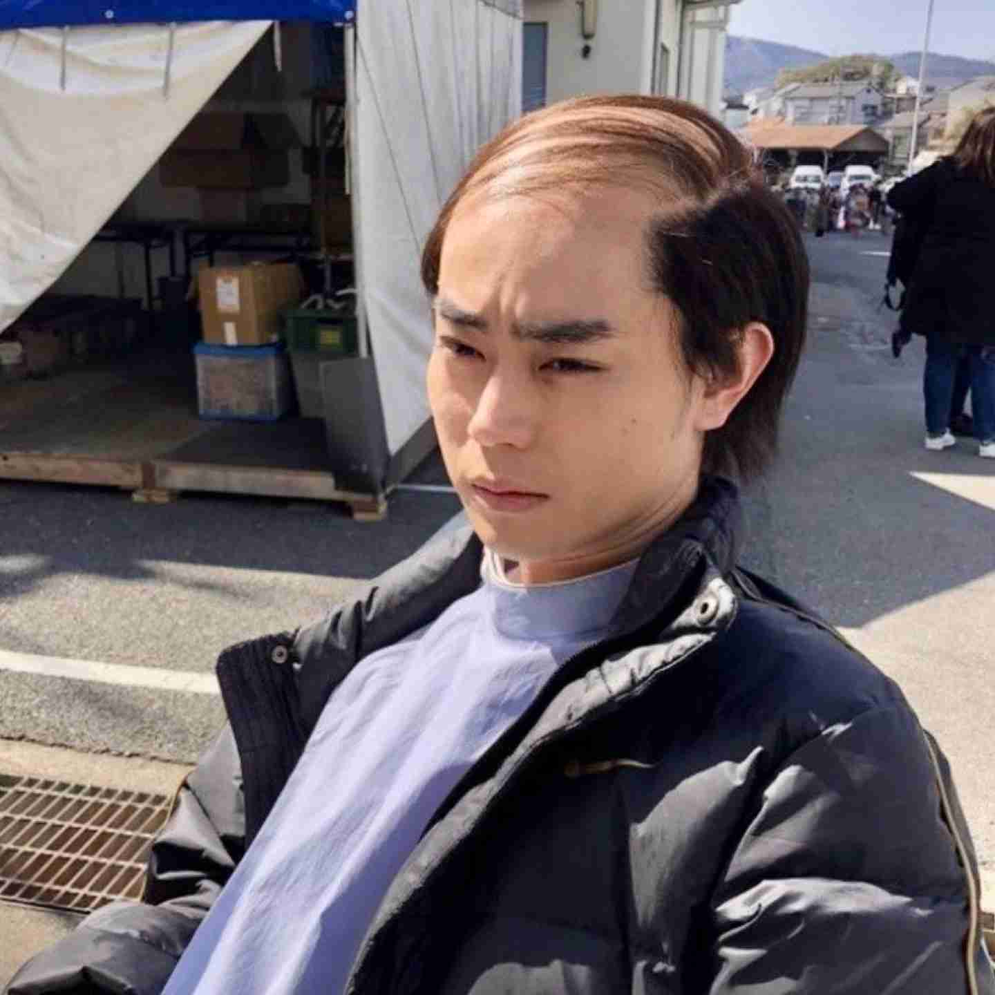 至急!ハゲた友達を励ますには