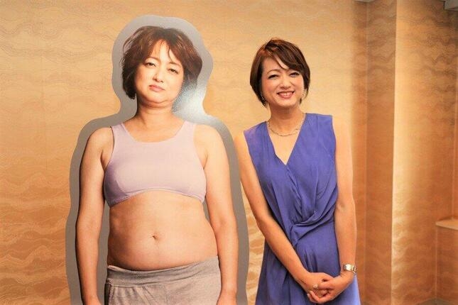 足が「壊死」の可能性…診断から５年　元木大介氏　変ぼうした現在の姿「すごい」病名も公表で反響