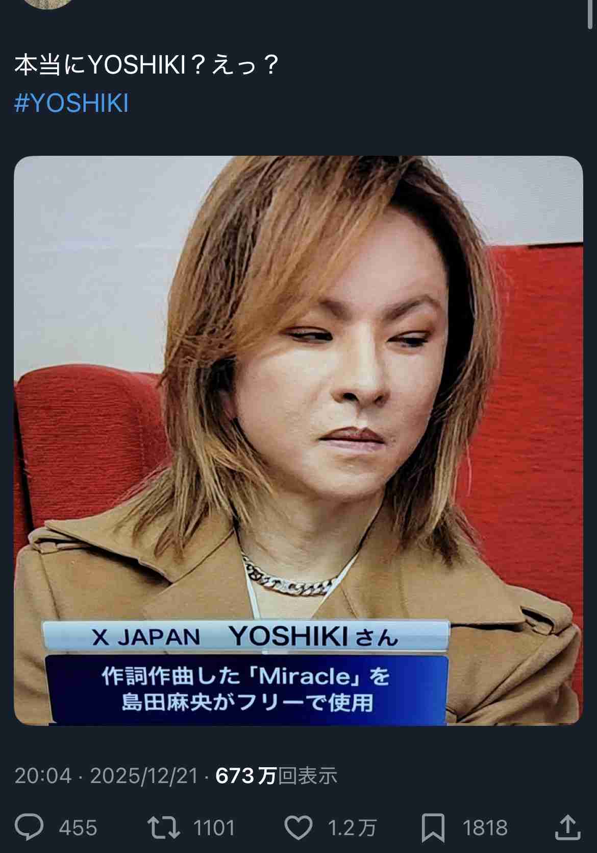 YOSHIKI、小学館との和解成立　和解金の有無は開示せず　１.１億円の損害賠償求める裁判