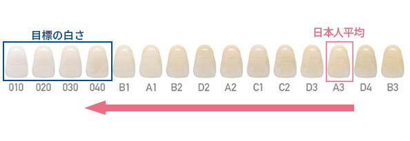 歯を白くしたい