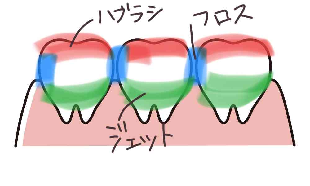 ジェットウォッシャーってどうですか