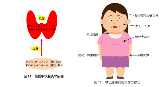 更年期の橋本病辛い😭