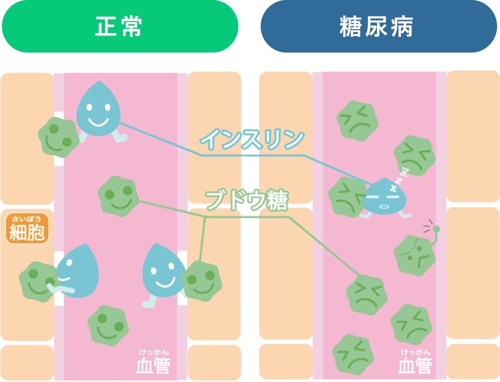 糖尿病予備軍の人〜