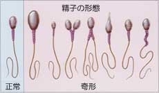 都玲華、週刊誌報道認め直筆で”謝罪文”、30歳年上の石井忍コーチとの「交際関係およびコーチ契約を解消」「両親を悲しませることは出来ない」