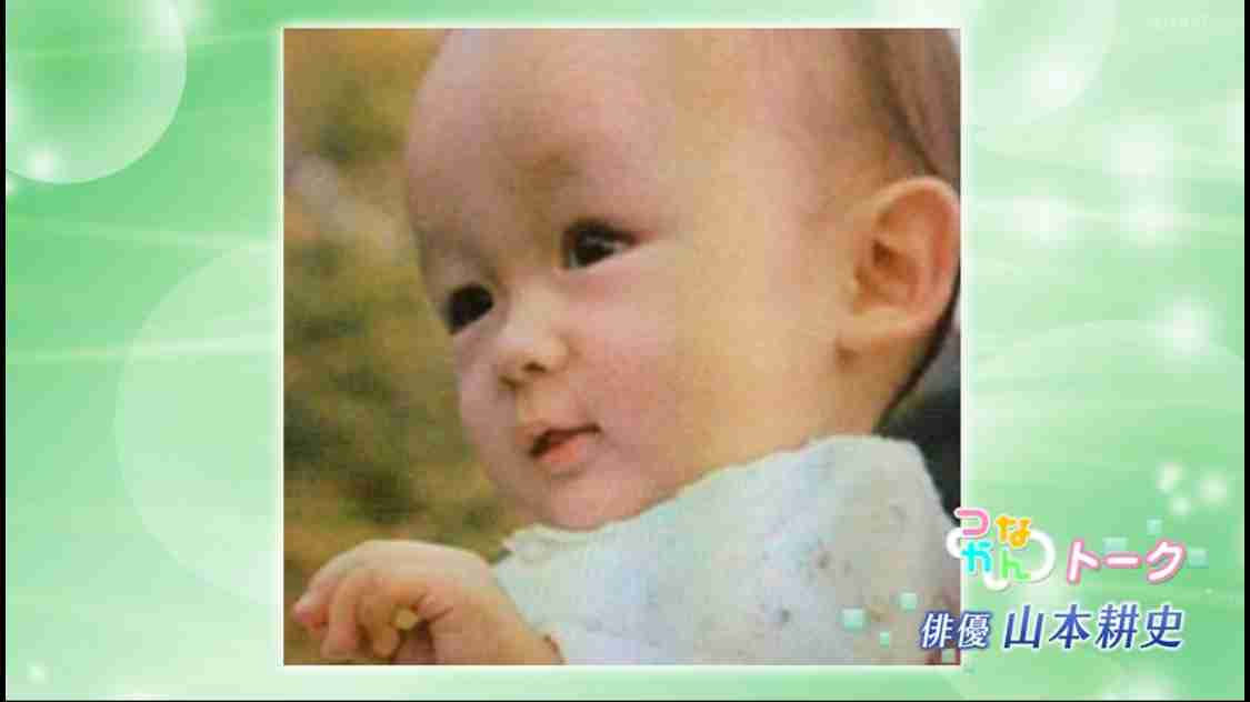 子供の頃からおでこが広い人