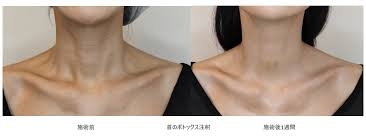 首のケアしてますか？【アンチエイジング】