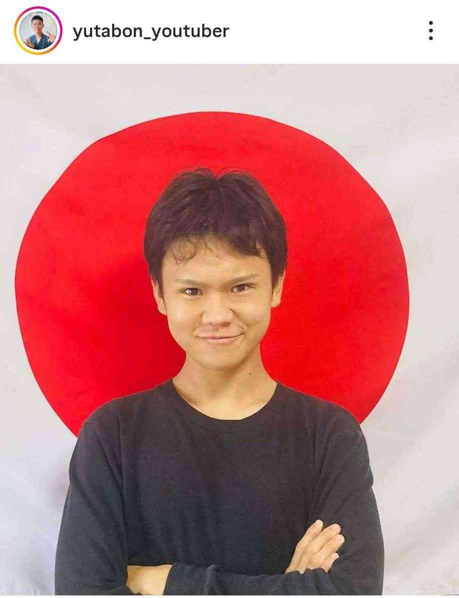 【美容整形】不自然な顔【加工】