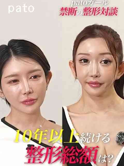 【美容整形】不自然な顔【加工】