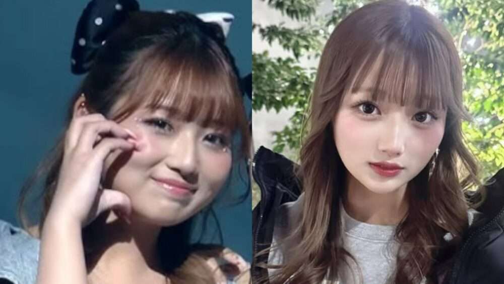 【美容整形】不自然な顔【加工】