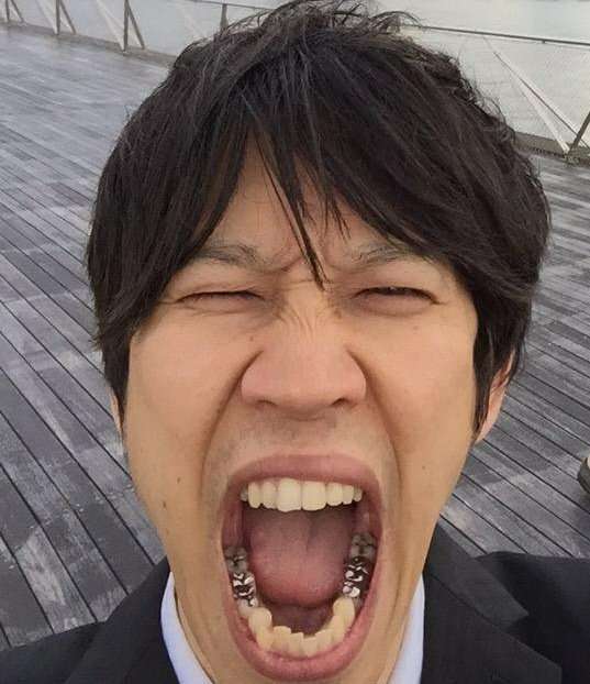 歯の被せ物どうしてる?