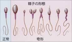 高齢化と分散化が進む…初婚年齢の実情(2025年公開版)