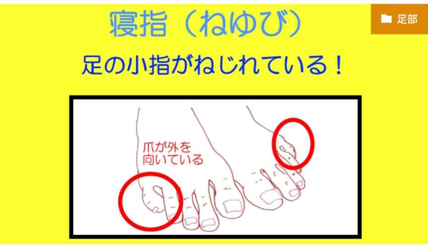 足の小指が寝指