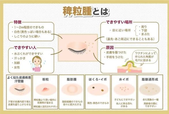 ガルでおすすめされて使ってみた商品の感想を報告するトピ