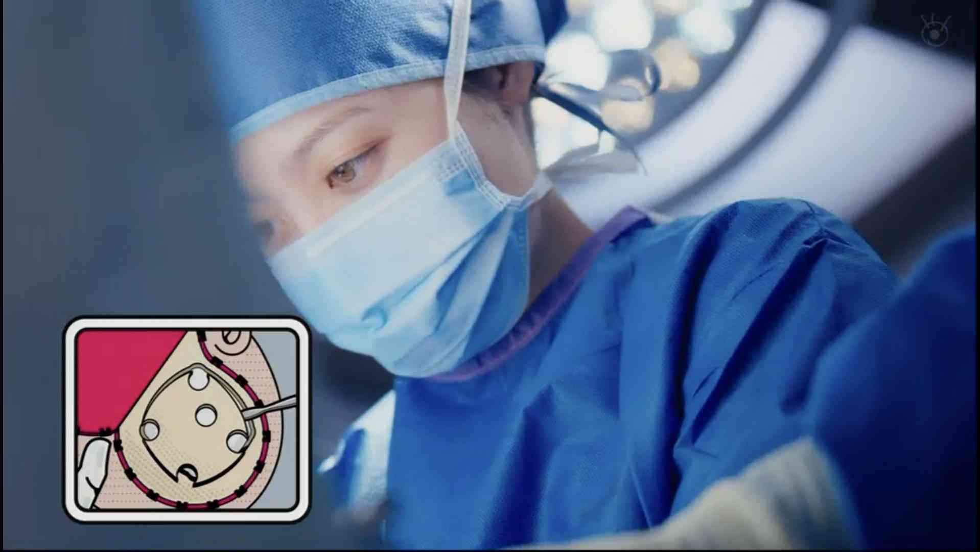 「なぜまたやろうと思った」橋本環奈　月9ドラマが急降下…“歴代最低視聴率”朝ドラの脚本家との“再タッグ”に疑問の声