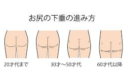 お尻に自信がありますか？