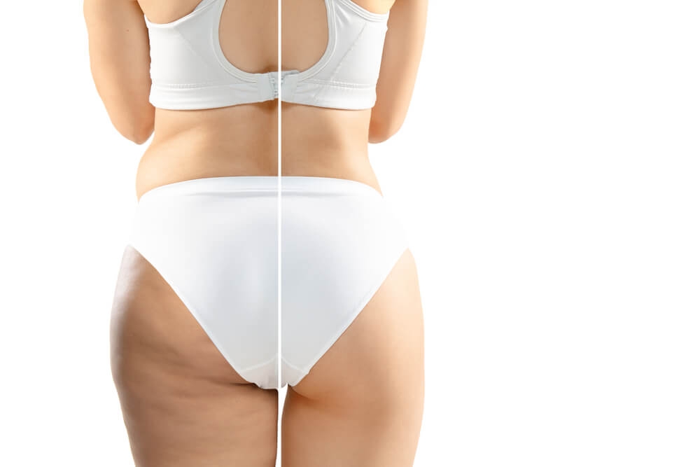 お尻に自信がありますか？