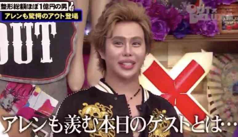 アレン様　衝撃の月額美容代「40～50万とかザラに。エステも16万くらい」若槻千夏「何すんの？」