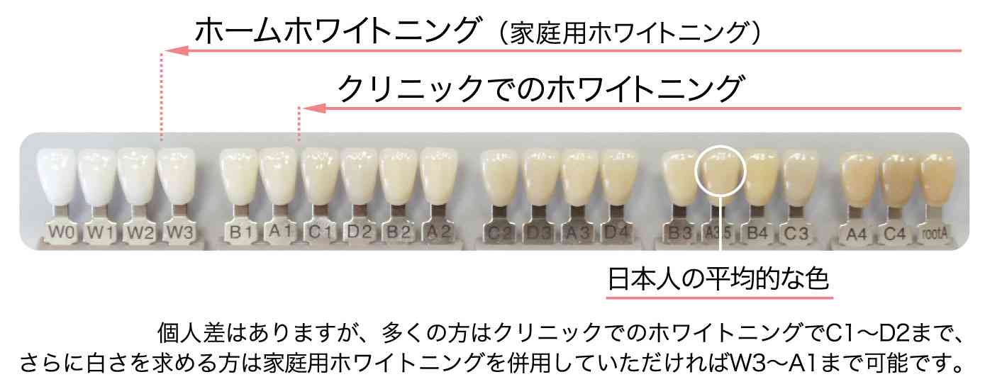 歯の着色が気になる人part2