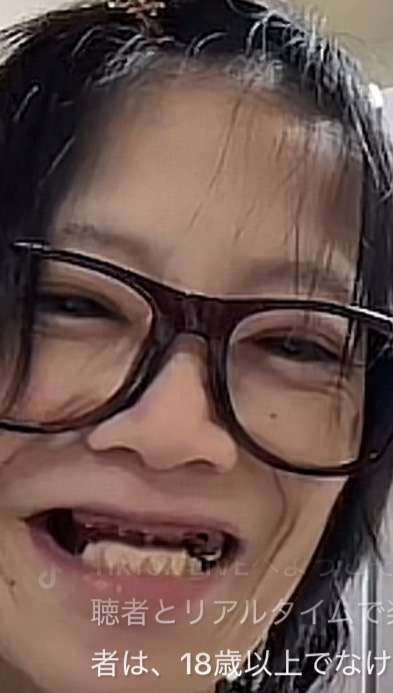 明日花キララ「死んじゃいけない」　美容整形の全身麻酔でパニック、前歯が欠けた姿に「そこまでして」分かれる賛否