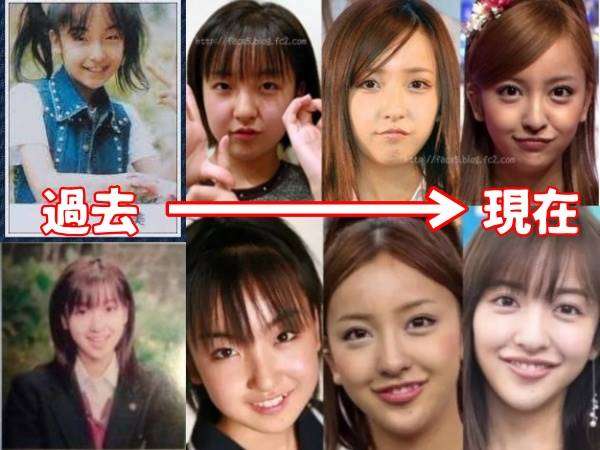 元AKB48・相笠萌、10年間で「顔変わりすぎ」に反論「このくらいは変わるだろ」「チー牛は黙ってて」　ネット「お綺麗になられて」