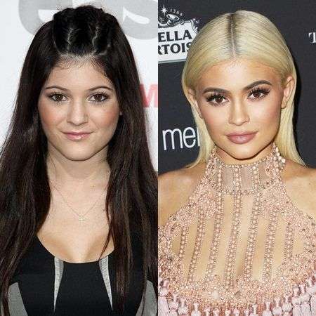 ケンダル・ジェンナー、整形完全否定で炎上「さすがに嘘」衝撃Before→After写真にSNS失笑&疑惑再燃