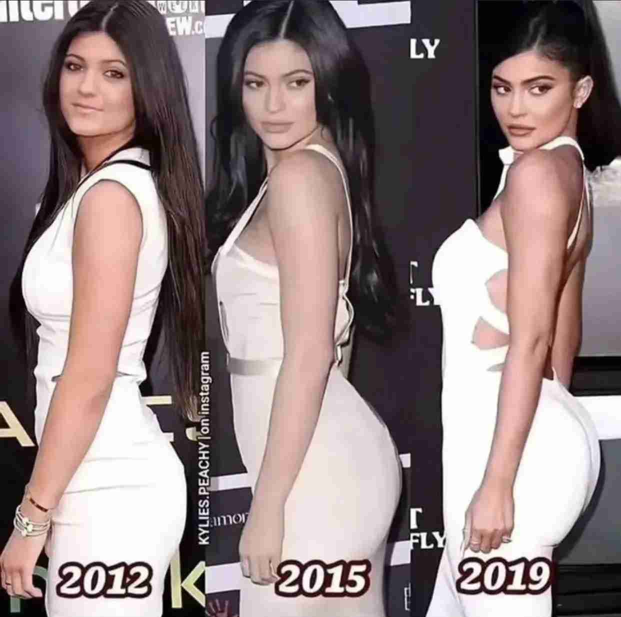 ケンダル・ジェンナー、整形完全否定で炎上「さすがに嘘」衝撃Before→After写真にSNS失笑&疑惑再燃