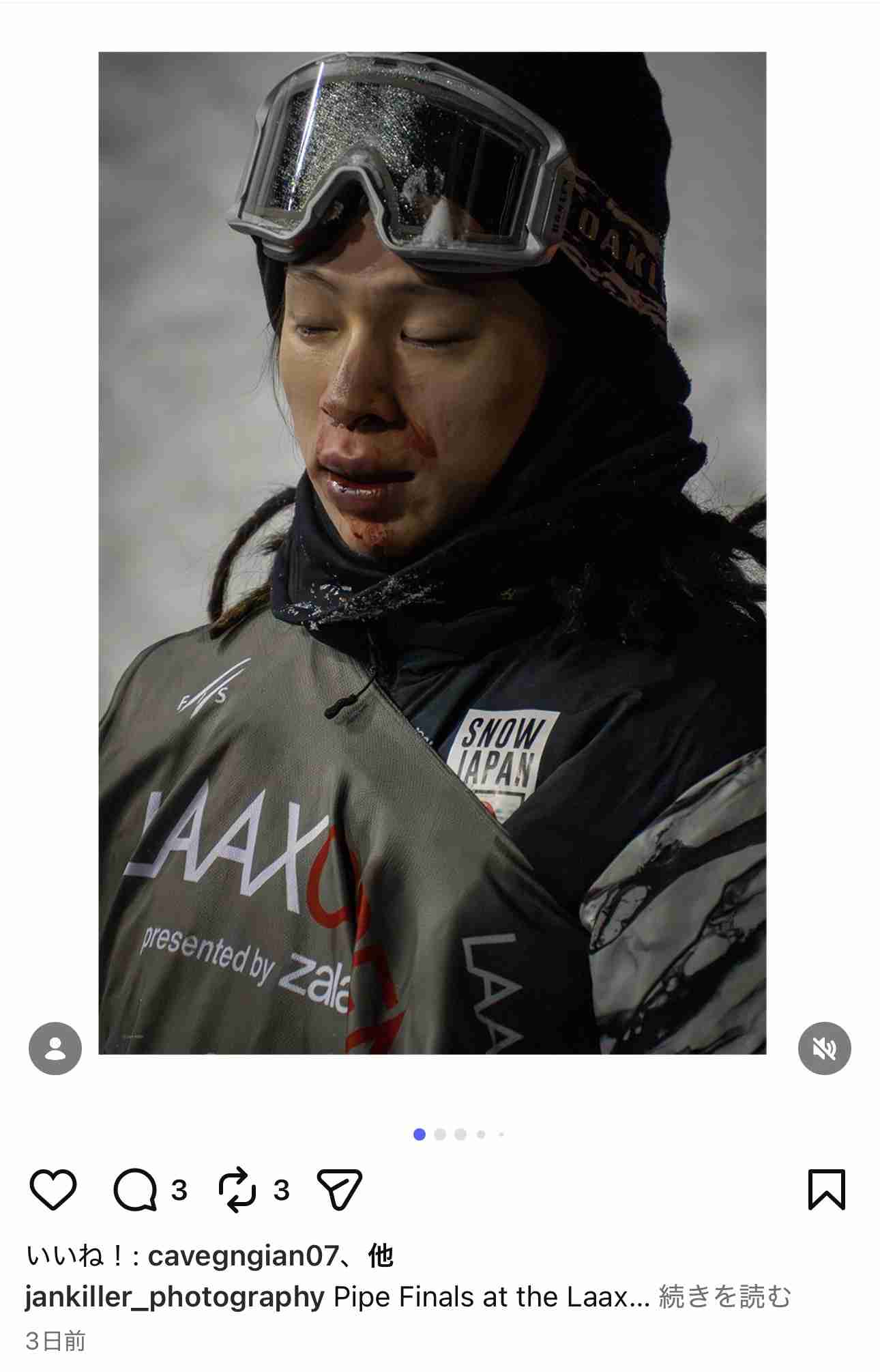 平野歩夢は複数箇所の骨折と打撲、スキー連盟が発表 国内で治療、リハビリ後に代表合流目指す