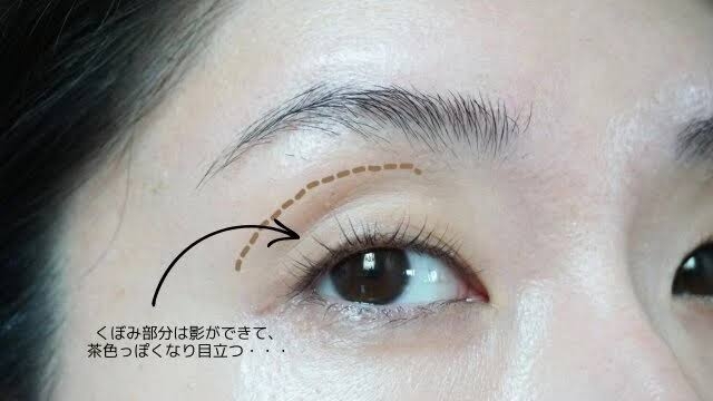 上まぶたのヨレ・しぼみ