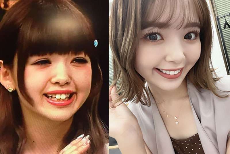 美人に比べてイケメン少ない