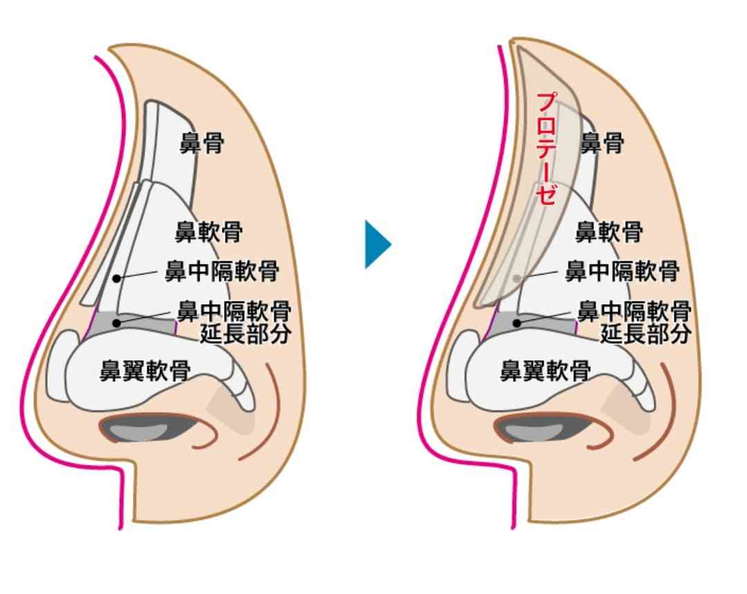 あなたの憧れる顔 Part3