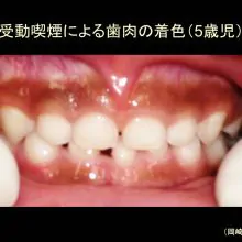 タバコは百害あって一利なしであるも、喫煙者がおしなべて不健康で短命でもないという矛盾…喫煙歴のある薬学博士が解説
