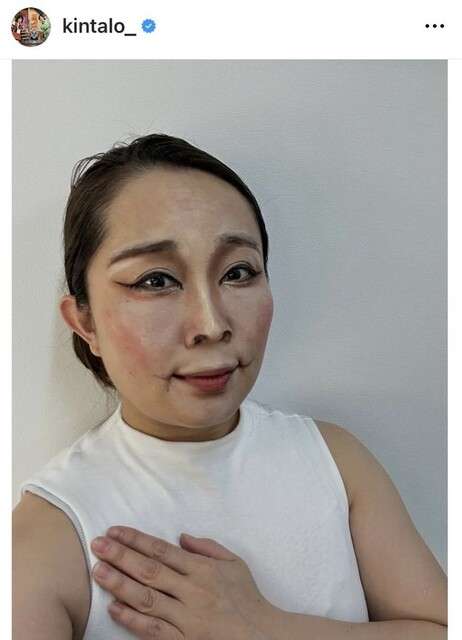 キンタロー。「生きてると日々理不尽な事色々言われてさ」…「メンタル落ち込んだ時の対処法」公開「りくりゅう」ものまねの反応が尾を引く？
