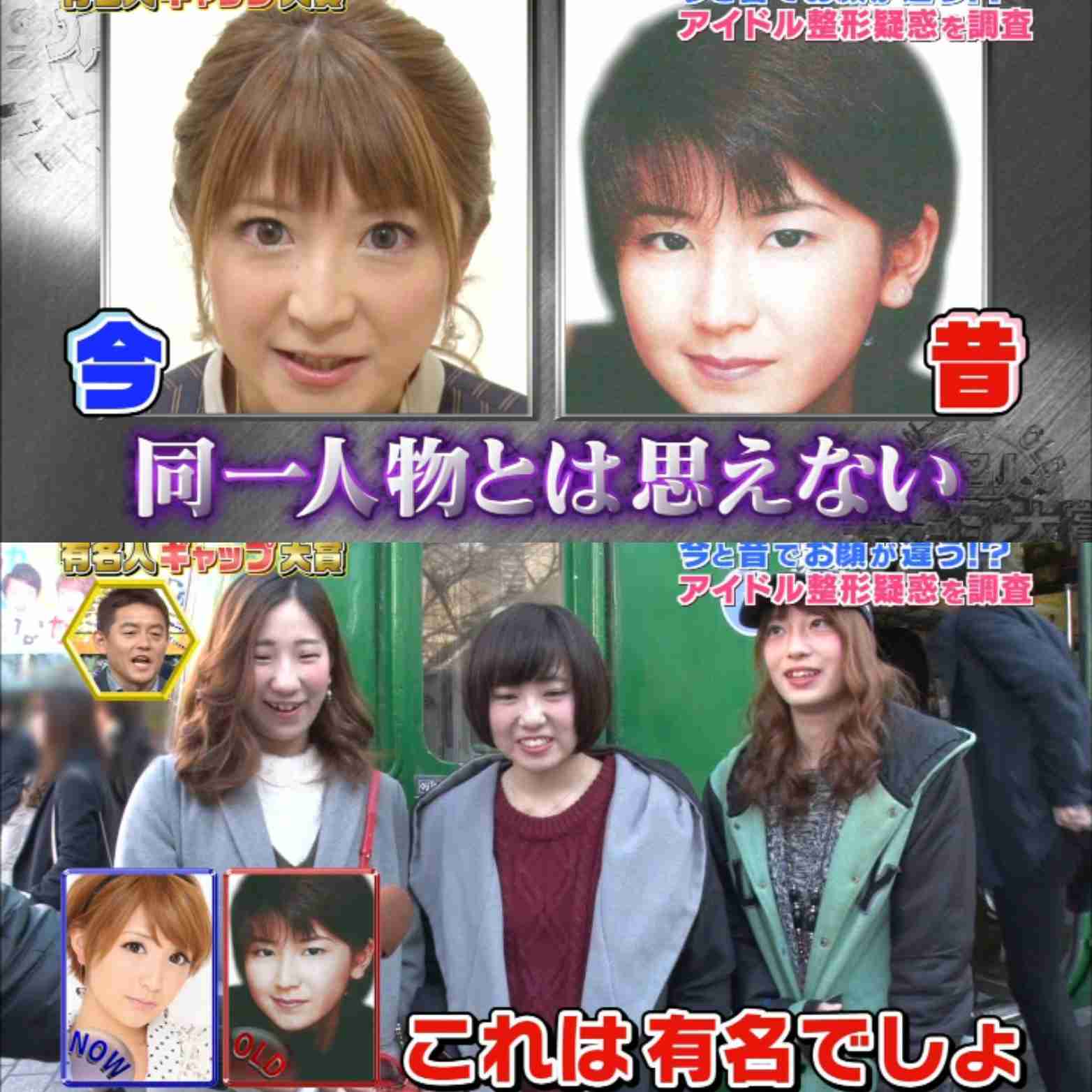 矢口真里「整形した方が早かった…」 二重つくるアイテープ代に86万円超 今後の整形に意欲