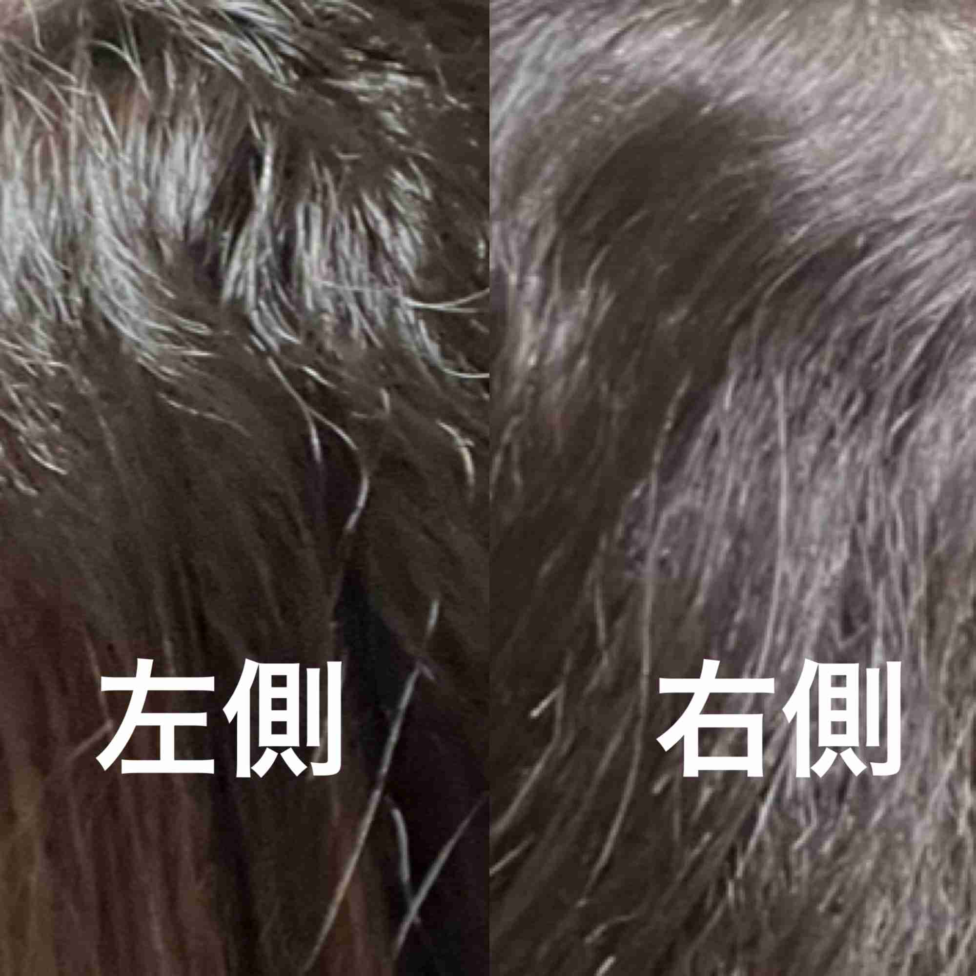 23年間続けた縮毛矯正を辞めた女性。1年半後の姿に「信じられない」「ありのままでいられるって幸せ」