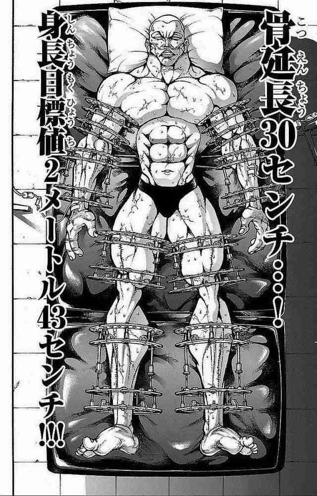 「1000万円で身長を買った」人気YouTuber、骨延長手術で7cm増も“無意識の過食”と“記憶障害”の壮絶リハビリ