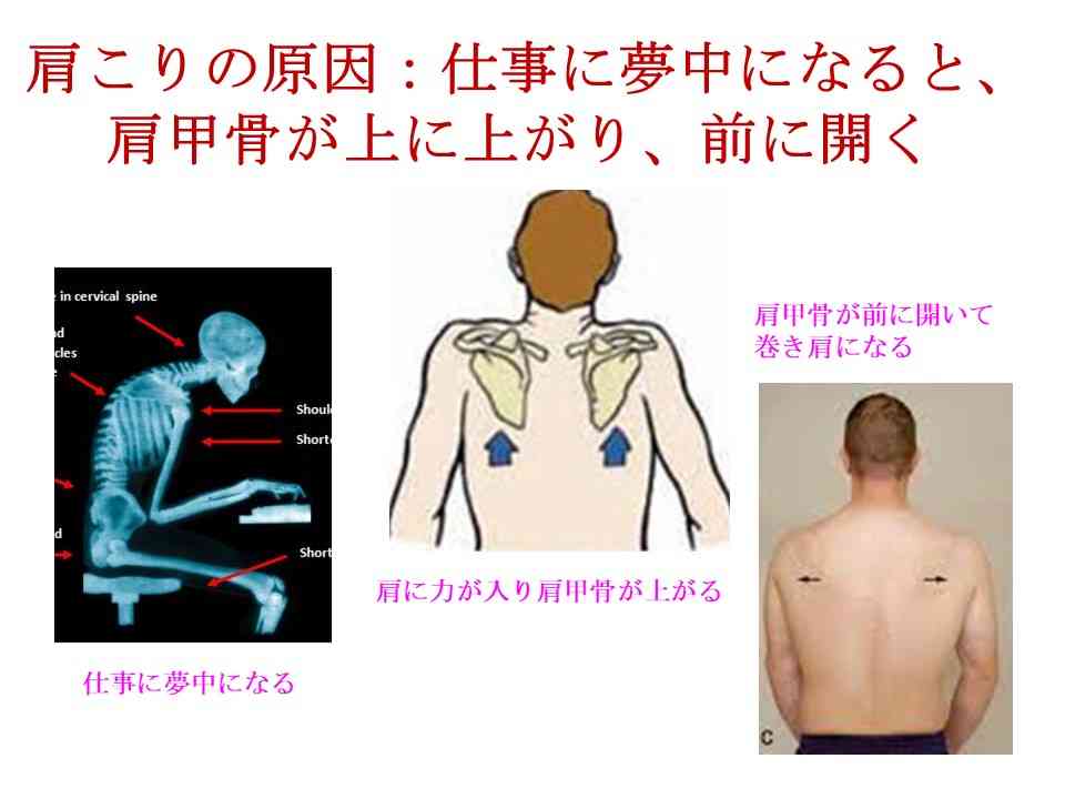 いかり肩、姿勢矯正