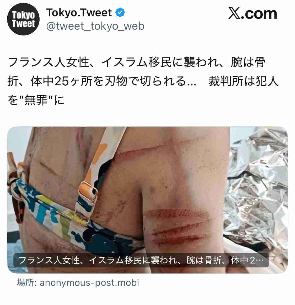 滋賀の山林に64歳女性の遺体遺棄容疑、22歳シリア国籍の男逮捕