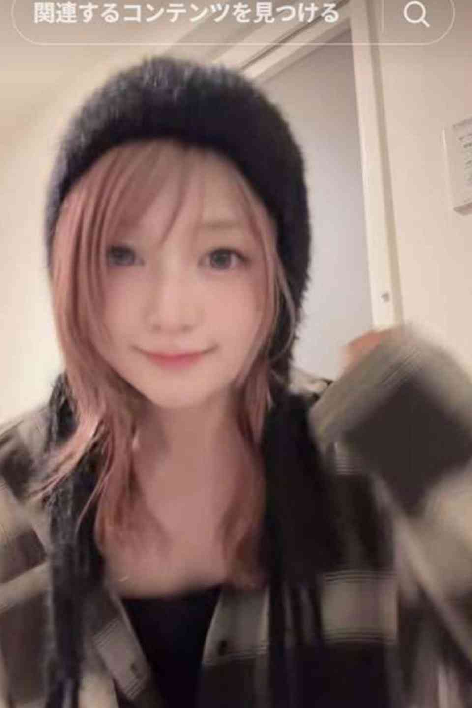 後天的に二重になった人