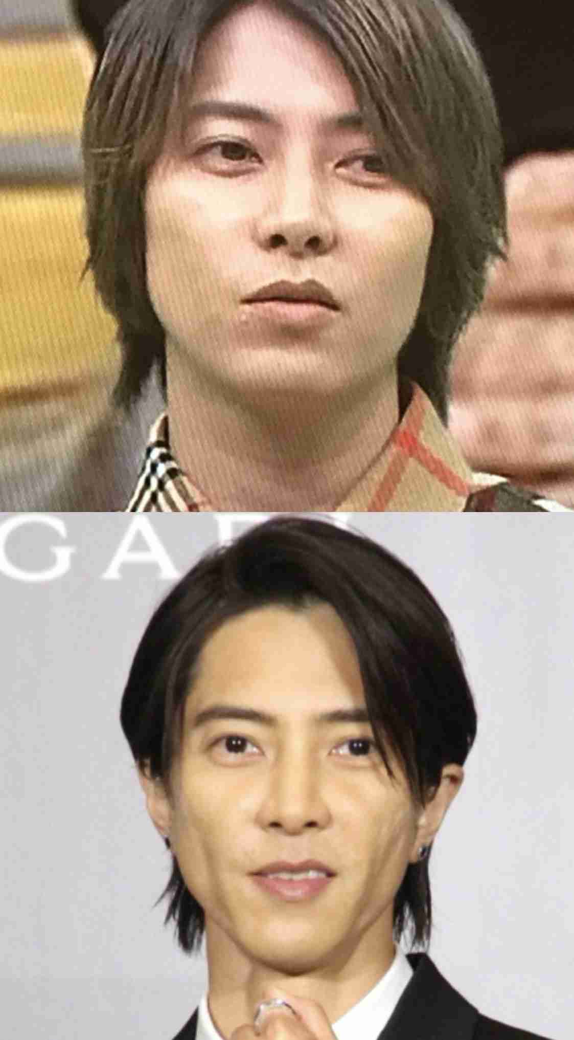 彼氏が整形してる