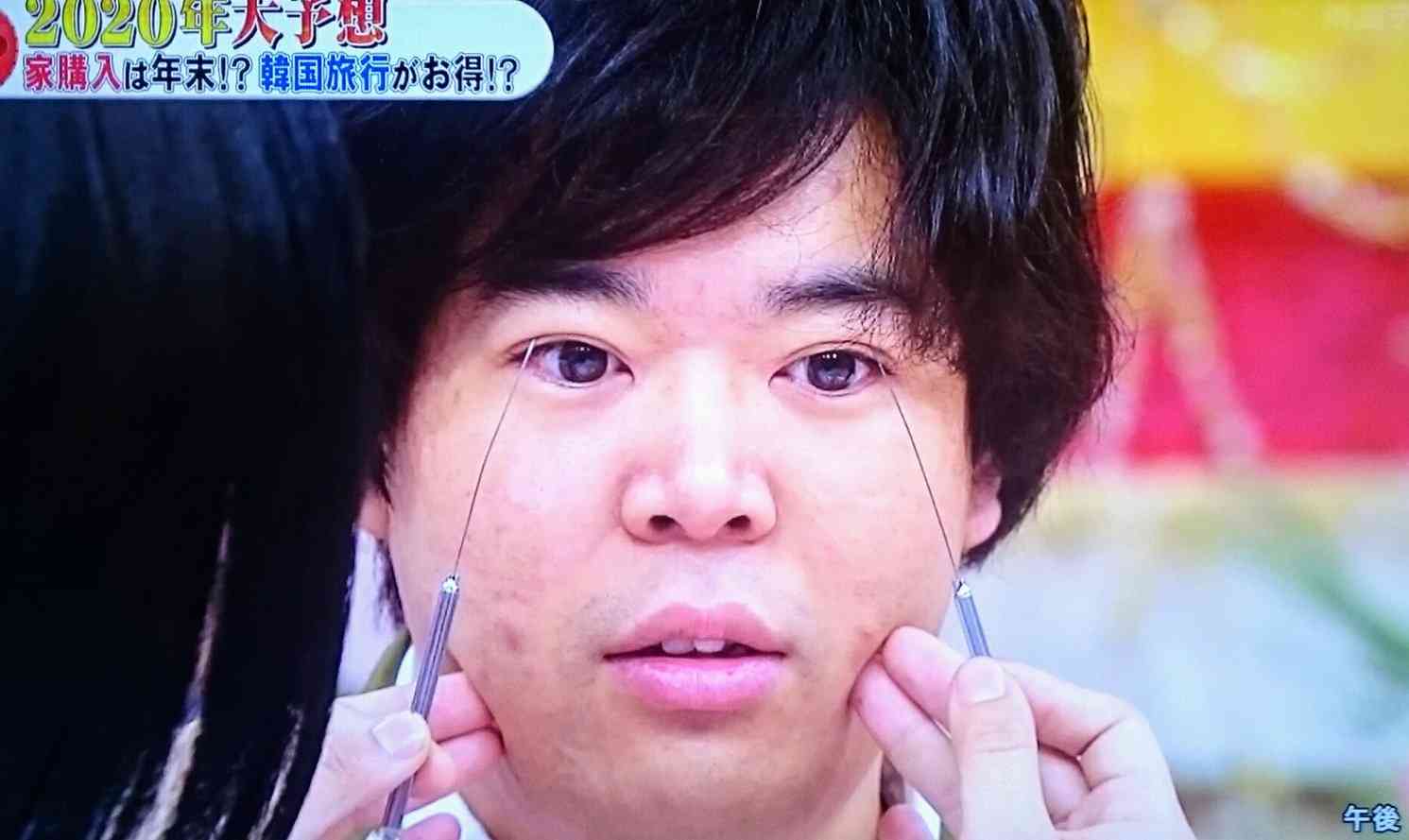 彼氏が整形してる