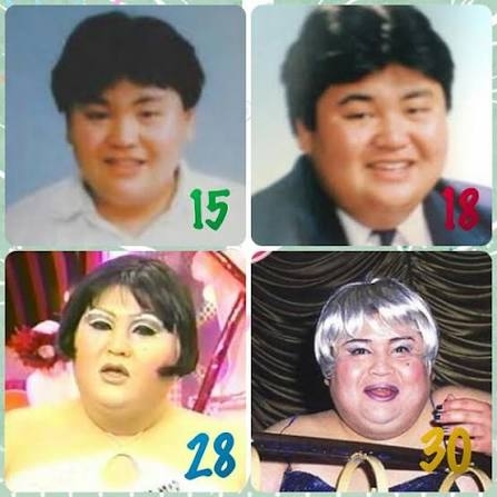 マツコ・デラックス、手術で入院「首の神経が圧迫されちゃって…」　復帰は「はっきりとはわからない」