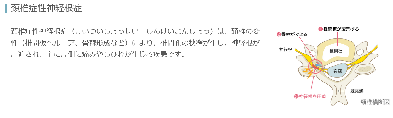 マツコ・デラックス、手術で入院「首の神経が圧迫されちゃって…」　復帰は「はっきりとはわからない」