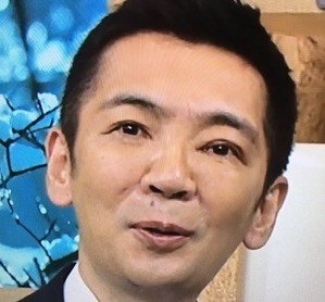 【整形】上瞼の脂肪取り