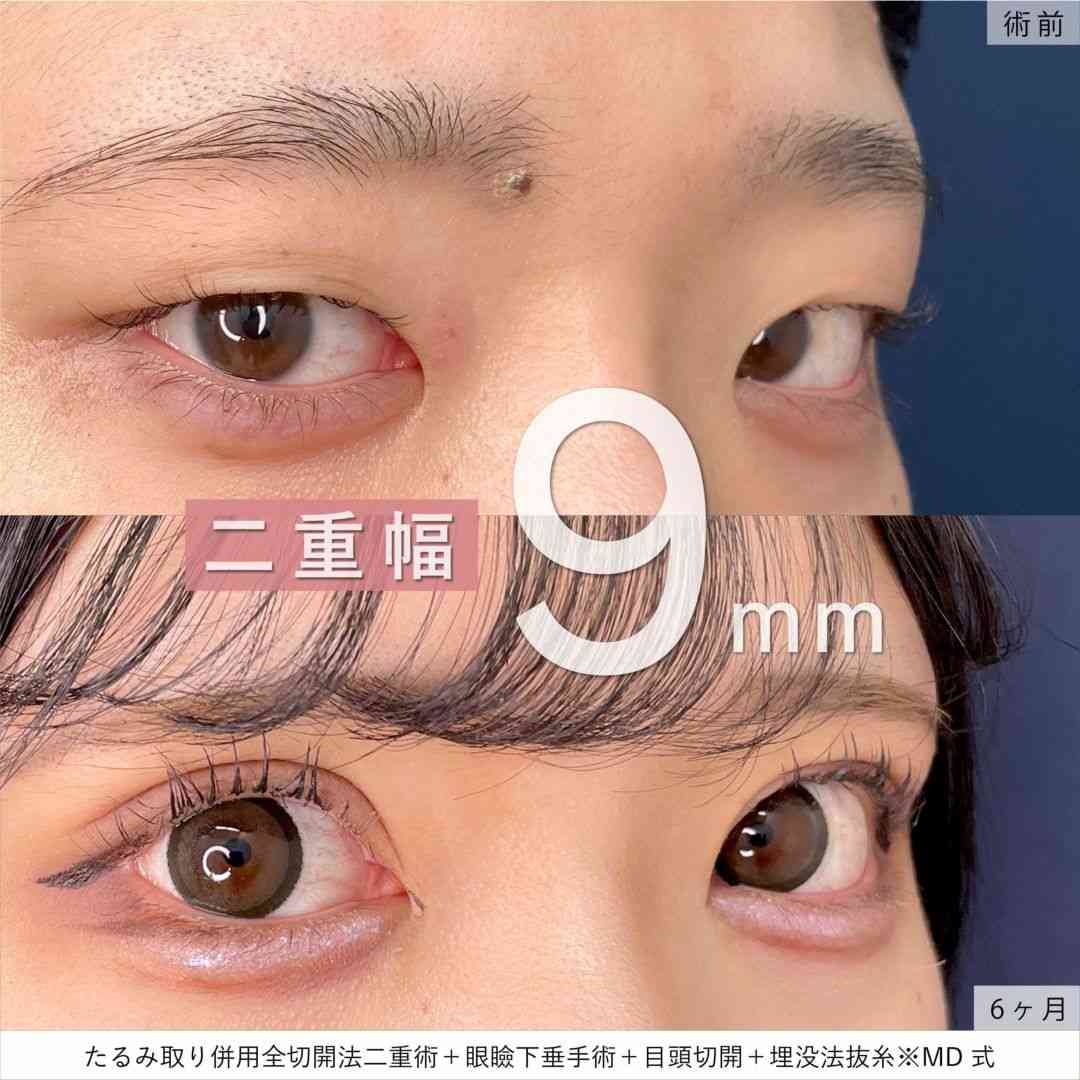 最近綺麗な人多すぎませんか?